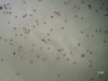 Spores de fougère "Me" (x40)