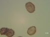 Spores de fougère "Me" (x400)