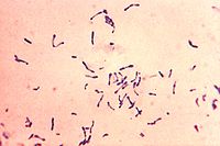 Corynebacterium diphtheriae or Klebs-Löffler bacillus