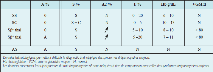Syndromes drépanocytaires majeurs