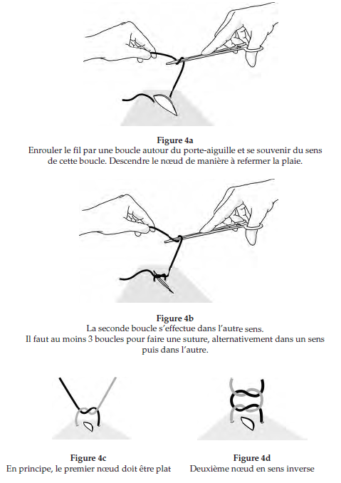 Figures 4 : Exercice de noeuds à la pince