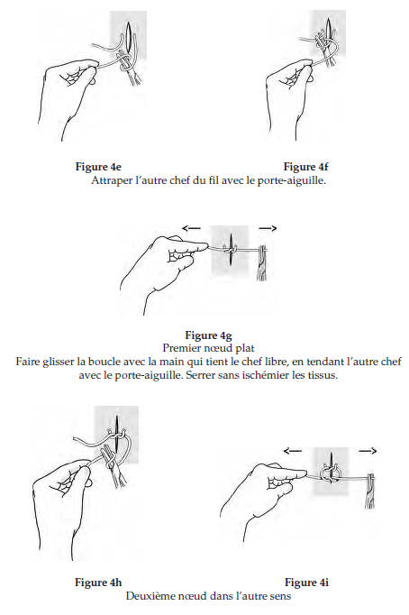 Figures 4 : Exercice de noeuds à la pince (suite)