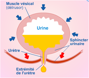 Incontinence urinaire