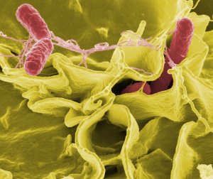 Salmonella - Citrobacter