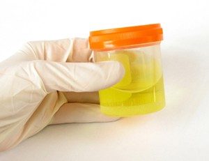 ECBU (examen cytobactériologique des urines)